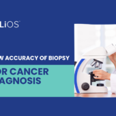 accuracy of biopsy for cancer